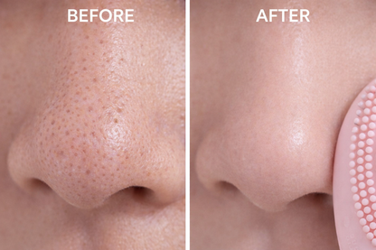 Deep Cleansing Facial Brush
